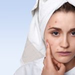 hormonal acne